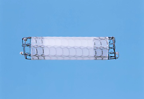 ウルトラフレックスステント カバー付きタイプ（金属ステント）の写真