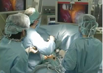 完全鏡視下手術の風景